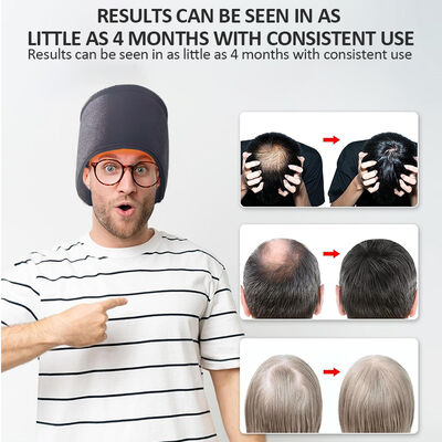 ৬৬০ এনএম হেয়ার গ্রোথ ক্যাপ LED রেড লাইট থেরাপি আর ২৭০ LED রেড লাইট আর লেজার থেরাপি ক্যাপ